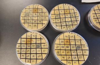 An image of screen for antibiotics-producing bacteria.